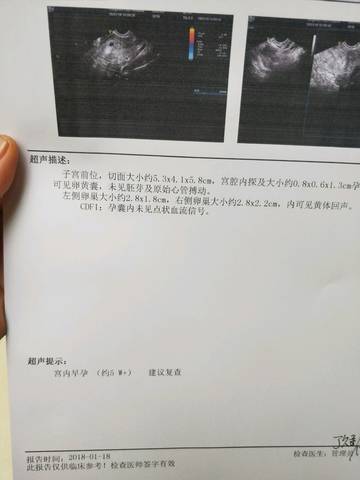 journal_insert_pic_928058801