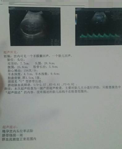 journal_insert_pic_929326178