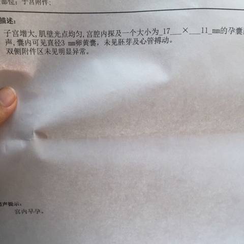 journal_insert_pic_929211915