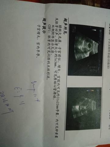 journal_insert_pic_929908583