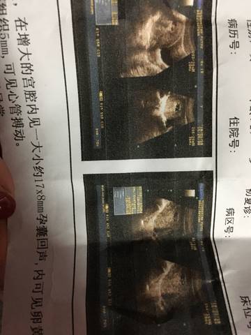 journal_insert_pic_931878000