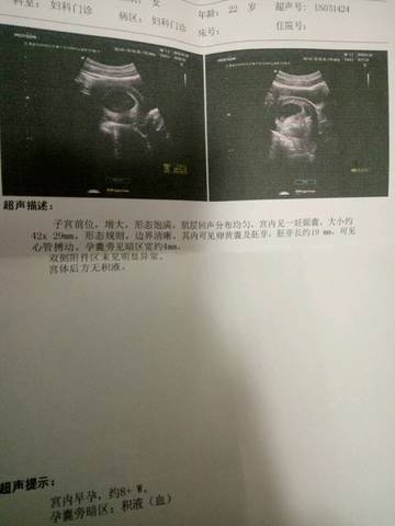 journal_insert_pic_931885486