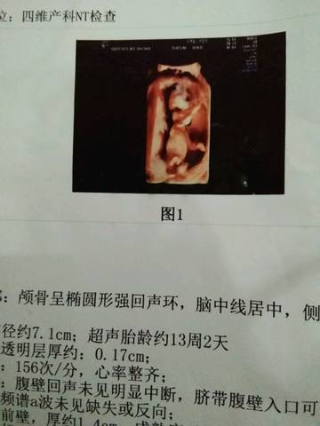 journal_insert_pic_932828170