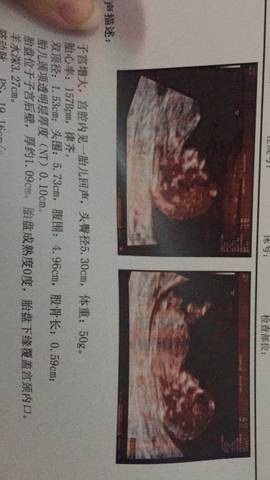 journal_insert_pic_935169201