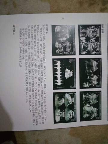 journal_insert_pic_934834969