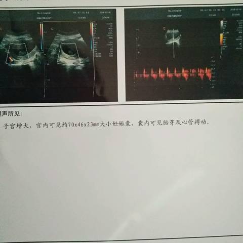 journal_insert_pic_937361479
