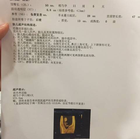 journal_insert_pic_940917688