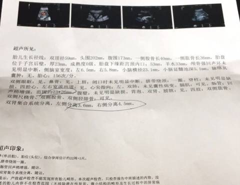journal_insert_pic_941512858