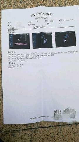 journal_insert_pic_941573085
