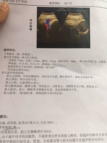 journal_insert_pic_943595264