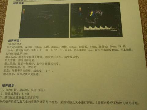 journal_insert_pic_944274997