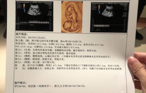 journal_insert_pic_944509694
