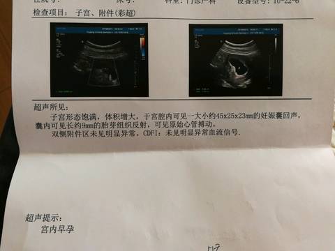 journal_insert_pic_945557515
