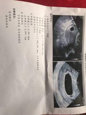journal_insert_pic_948109804