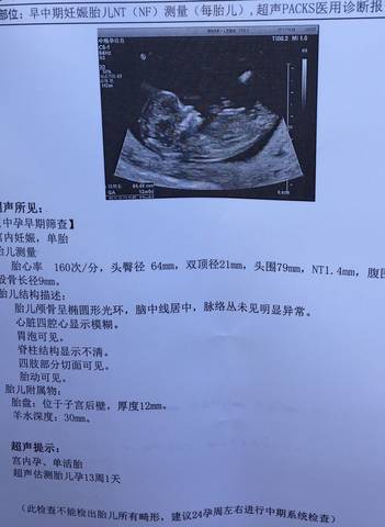 journal_insert_pic_950582049