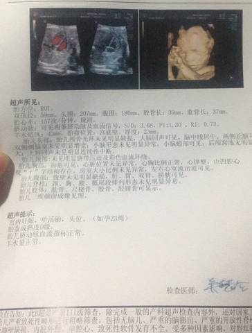 journal_insert_pic_951655091