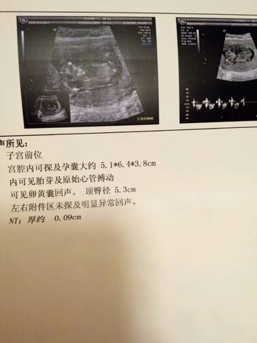 journal_insert_pic_951780370