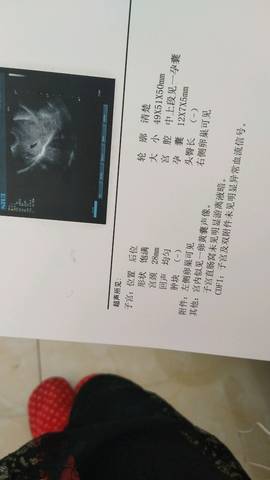 journal_insert_pic_953160614