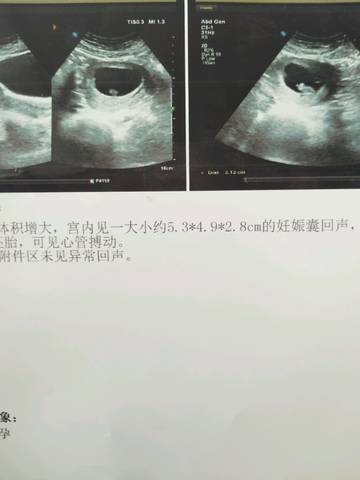 journal_insert_pic_953166535