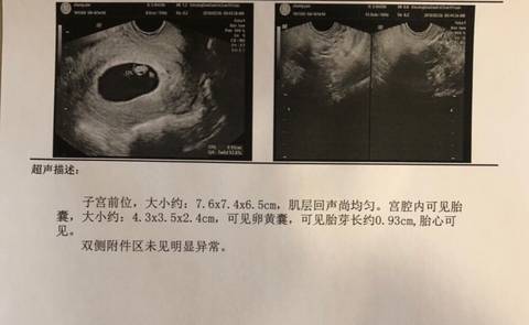 journal_insert_pic_953924751