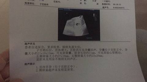 journal_insert_pic_953906378