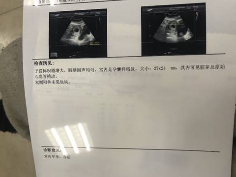 journal_insert_pic_955362259