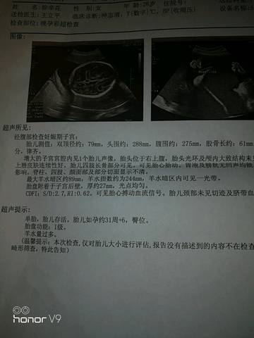 journal_insert_pic_956506141