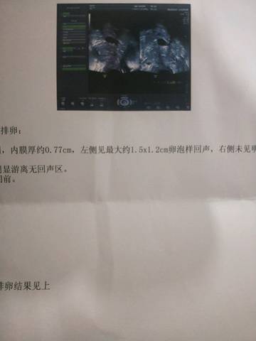 journal_insert_pic_959180615