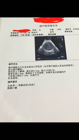 journal_insert_pic_960962632
