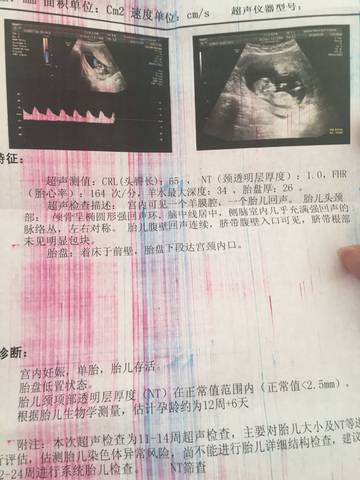 journal_insert_pic_962701477