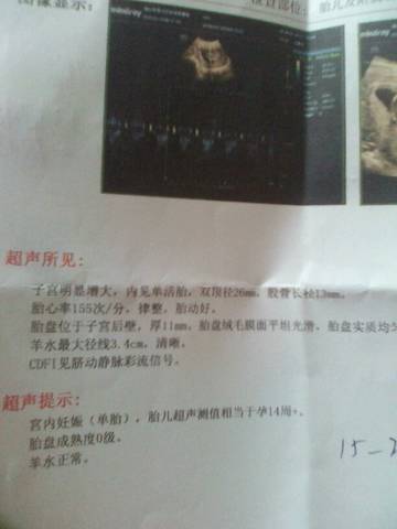 journal_insert_pic_963190133