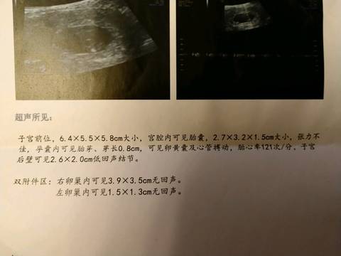 journal_insert_pic_965421574