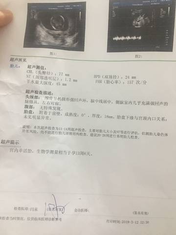 journal_insert_pic_965194424