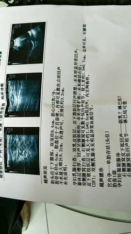 journal_insert_pic_965575860