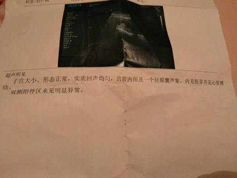 journal_insert_pic_966116615