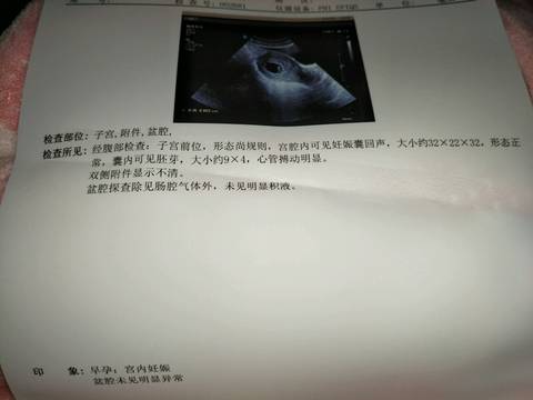 journal_insert_pic_966461093