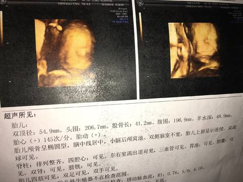 journal_insert_pic_966811017