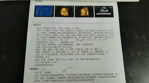 journal_insert_pic_967326382