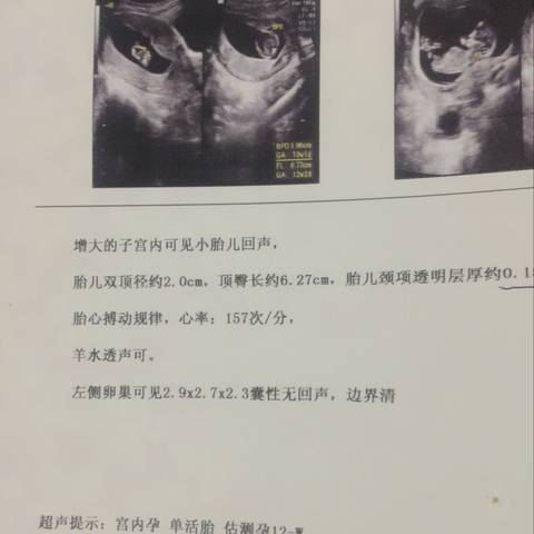 journal_insert_pic_968303452