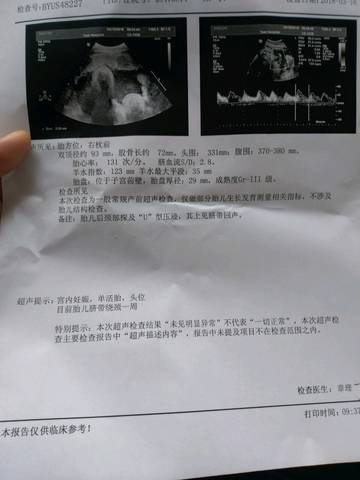 journal_insert_pic_967939702
