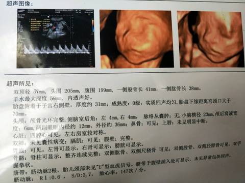 journal_insert_pic_968811865