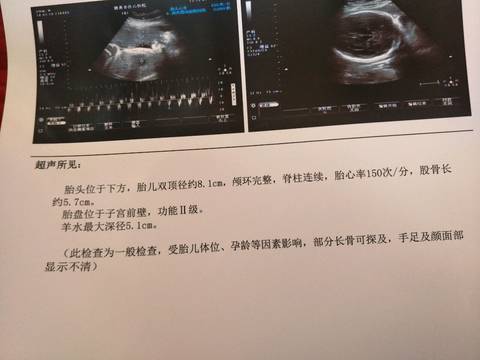 journal_insert_pic_970427301