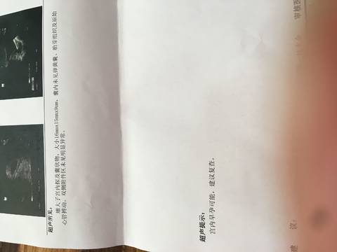 journal_insert_pic_970980716