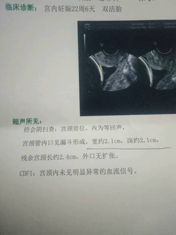 journal_insert_pic_972941609