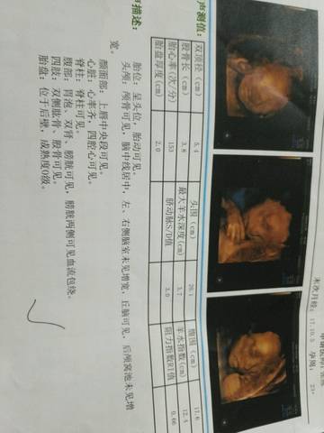 journal_insert_pic_976660564