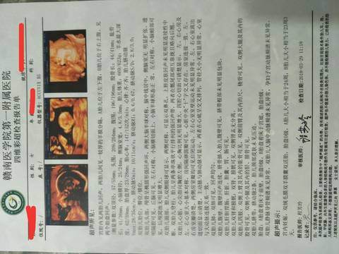 journal_insert_pic_978024987