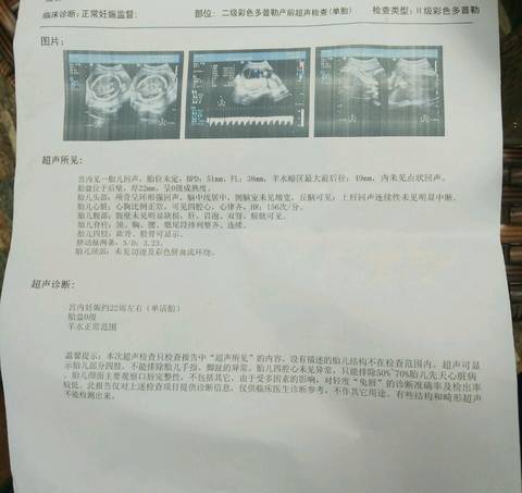 journal_insert_pic_979655353