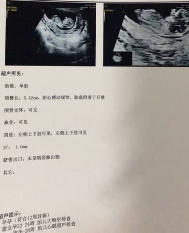 journal_insert_pic_982947664