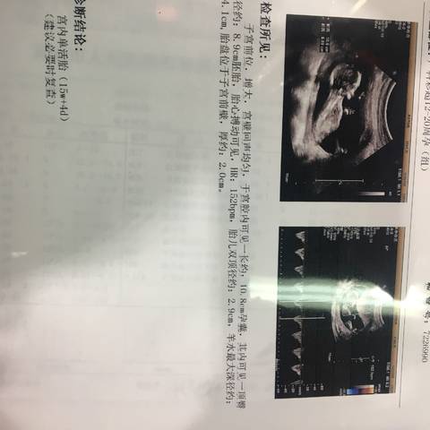 journal_insert_pic_986868829