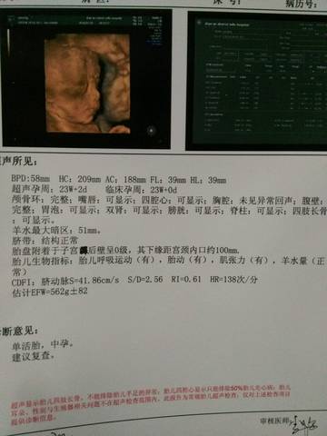 journal_insert_pic_987469329